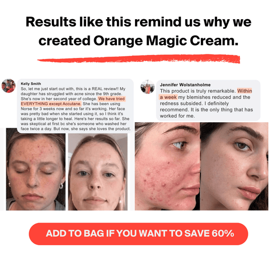 Orange Magic Cream