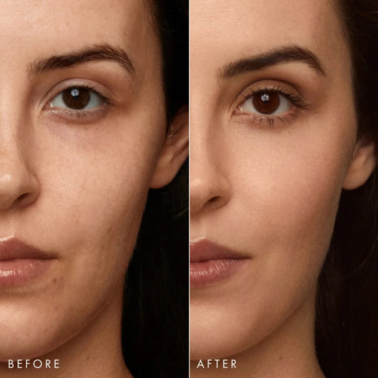 Before and after comparison of a woman's face with visible skin improvement.
