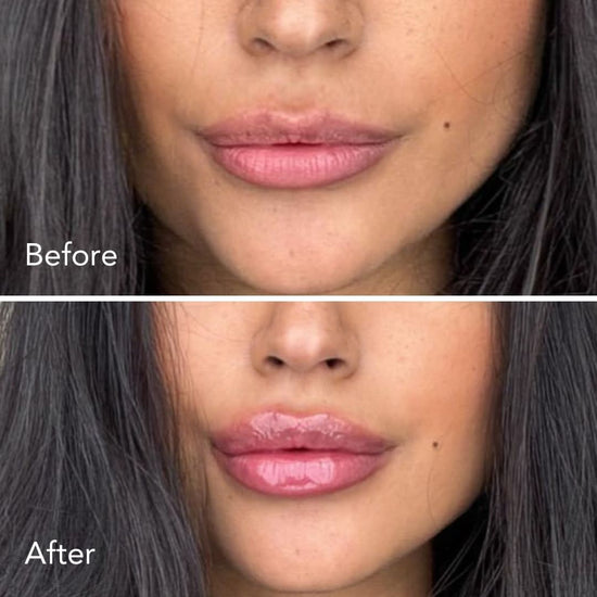Extreme Lip Plumper - Moska Cosmetics